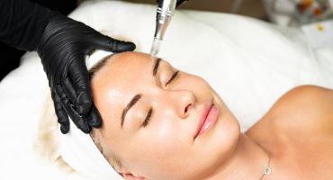 Skin resurfacing and tightening