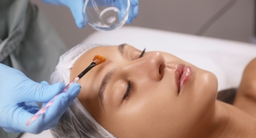 Chemical Peels