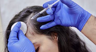 Hair Regrowth Therapy